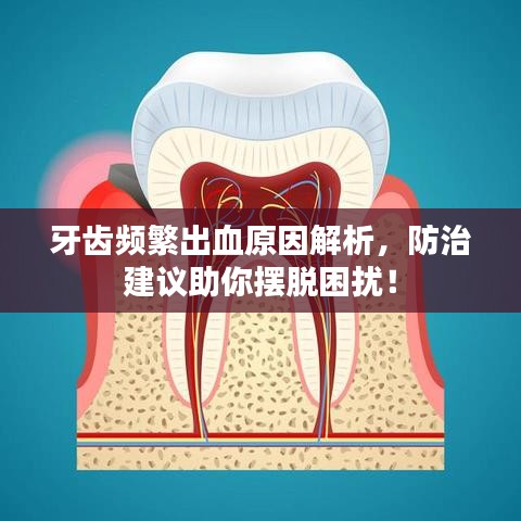 牙齿频繁出血原因解析，防治建议助你摆脱困扰！