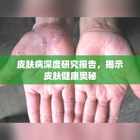 皮肤病深度研究报告，揭示皮肤健康奥秘